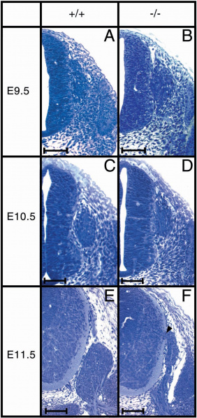 File:Structure of DRG in Sox10-deficient mice.jpg