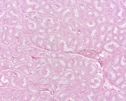 ANAT2241 Male Reproductive System - Embryology