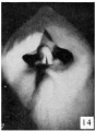 Fig. 14. Carnegie Embryo No. 194, female