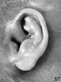 Fig. 57. Embryo No. 1702, 150 mm.