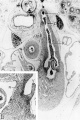fig 11 Pulmonary semilunar valves 31.5 mm embryo