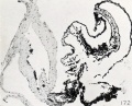 Fig. 172. Section of a part of the conceptus, showing chorionic membrane, cyemic (?) rudiment (x) and yolk-sac. No. 1843. (See Chapter XII.) X51.5.