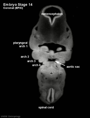 EFIC coronal image of embryo Carnegie stage 14