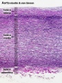 Aorta elastin label