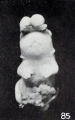 Fig. 85. Specimen with hare-lip and exencephaly. No. 364. X2.25.