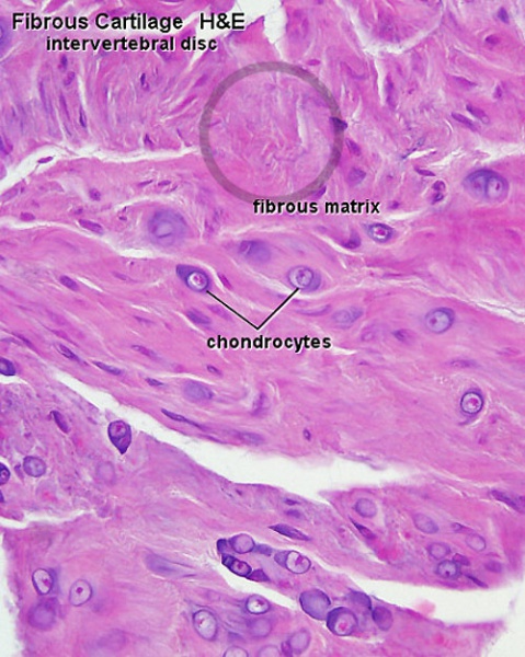 File:Fibrous cartilage 02.jpg