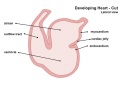 Heart septation 003 icon.jpg