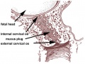 Cervical mucus plug
