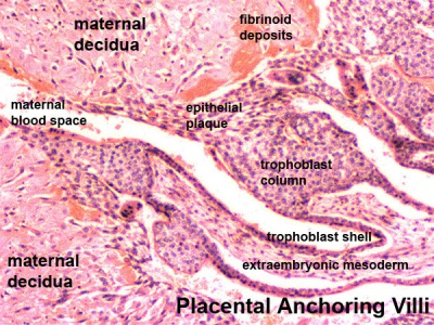 Placenta anchoring villi.jpg