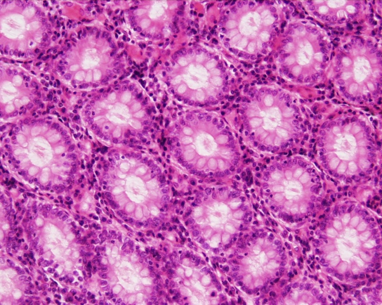 File:Colon histology 005.jpg - Embryology