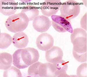 Malaria plasmodium falciparum.jpg