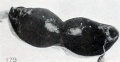 Fig. 179. Macerated tubal specimen imbedded in clot and undergoing lysis. No. 1938. X0.75.