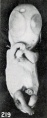 Fig. 219. An older fetus, showing bleb-formation and curvature in extremities, due to maceration and retention. No. 1860. XI- 35.