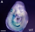 Otic placode of an embryo