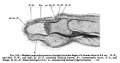 Fig. 215 Fetal Finger 8.5 cm 12 weeks (14 weeks GA)