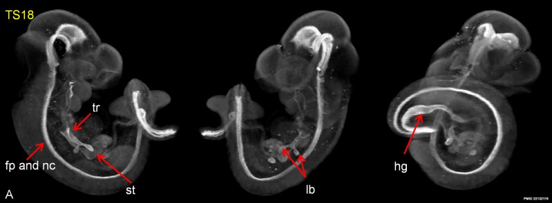 File:Mouse embryo E11 HNF3beta notochord marker 01.jpg