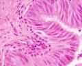Adult human, H&E, ductus deferens, pseudostratified columnar epithelium, stereocilia, x40