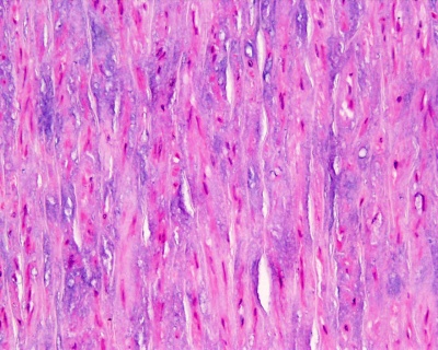 Artery histology 15.jpg
