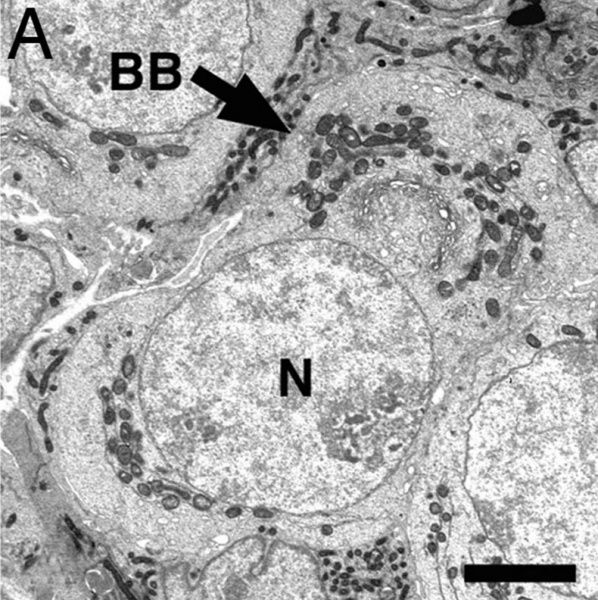 File:Mouse neonatal ovary oocyte EM02.jpg