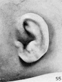 Fig. 55. Embryo No. 19576, 119 mm.
