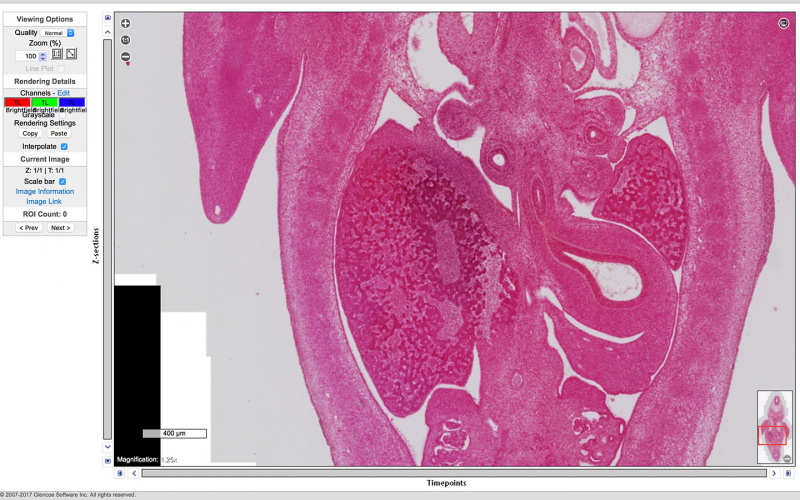File:Embryo-1951-09-01-Slide-60 Scene11-2.jpg