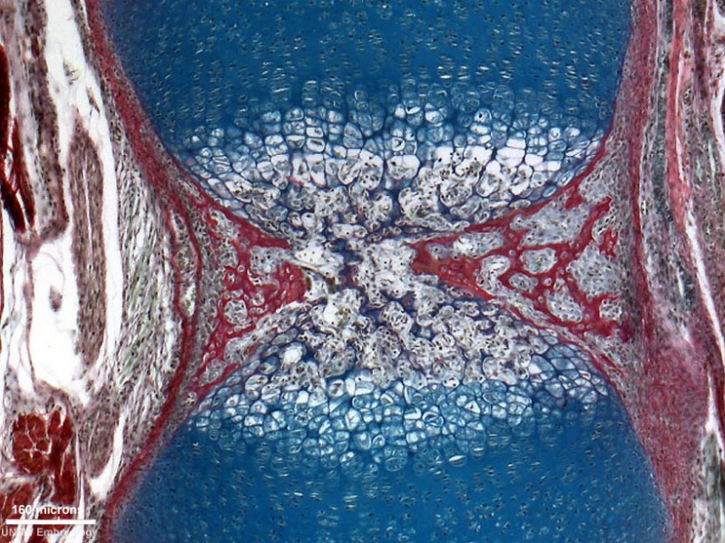 File:Ossification endochondral 01.jpg