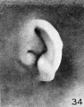 Fig. 34. Embryo No. 642, 49 mm.