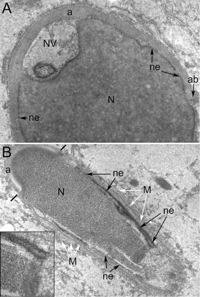 File:Human spermatid electron micrograph.jpg