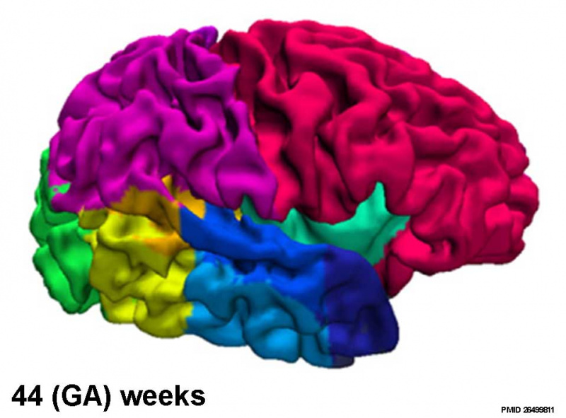 File:Fetal brain MRI04.jpg