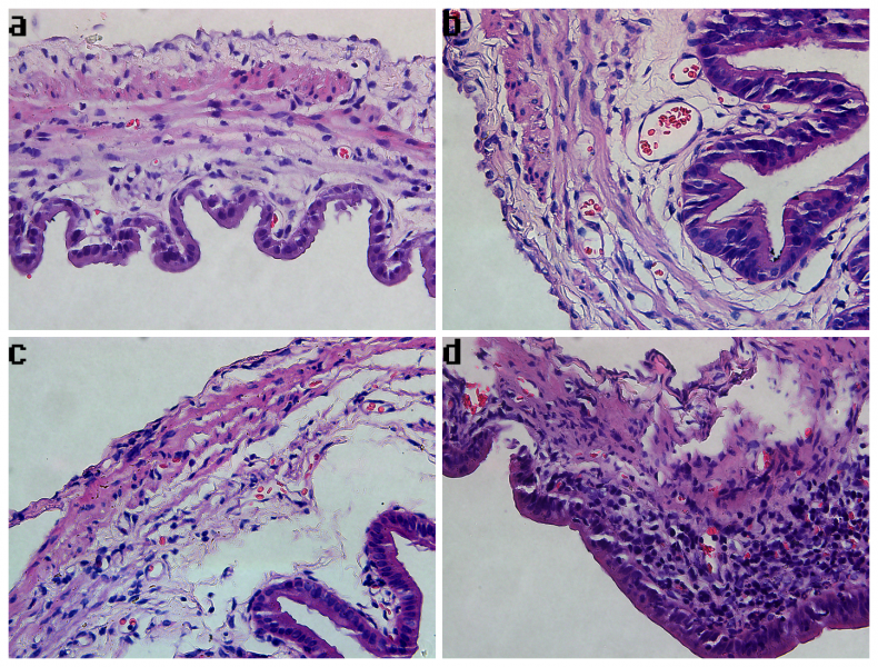 File:Photomicrographs of gallbladder samples stained with hematoxylin and eosin in each group.png