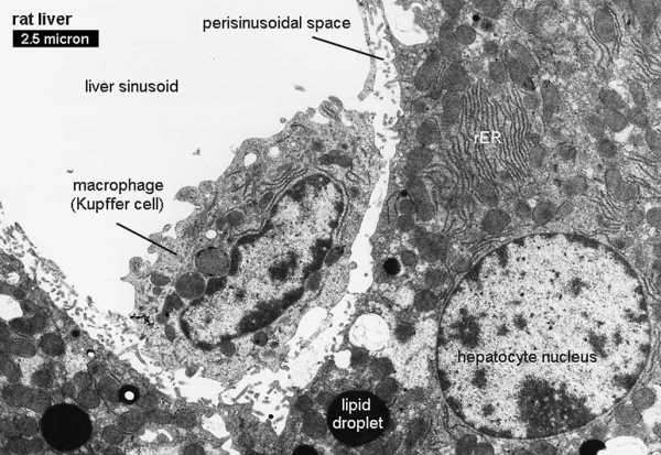 Liver histology EM01.jpg
