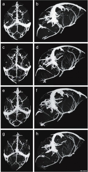 File:Mouse E18 cerebral vasculature MicroCT.jpg