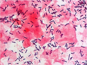 Bacteria - gram-stained vaginal smear