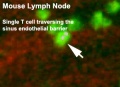 Mouse adult lymph node 04.jpg