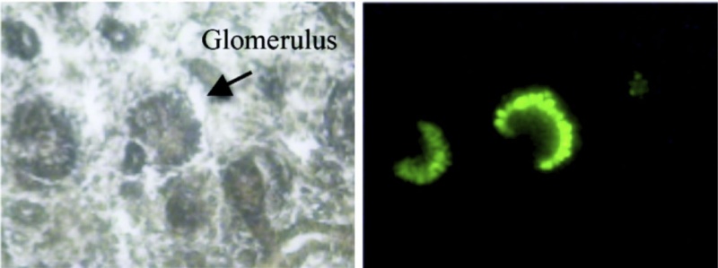 File:Renal - early glomerulus.jpg