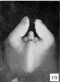 Fig. 19. Carnegie Embryo No. 2393, female