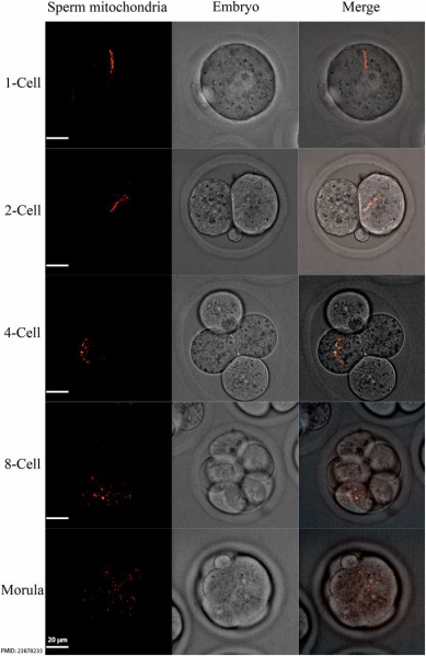 File:Mouse spermatozoa mitochondria 01.jpg