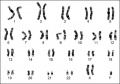 Z3289301 - Image is very relevant to group topic. This is a better version than the first Karyotype 1 and Karyotype 3. Legend does give explanation of what is shown. Citation, copyright and student disclaimer included. Why has the group included 3 different versions of the same Karyotype? This suggests a lack of co-ordination within the group. Only the best should have been used and probably only once or twice within the project.