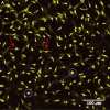 Mouse-melanoblast migration icon.jpg