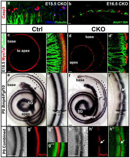 File:Atoh1 hair cell loss.png