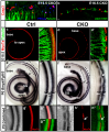 Conditional deletion of Atoh1 results in death of organ of Corti cells and patchy Myo7a-positive presumptive hair cells which are innervated by many nerve fibers.