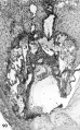 90 A medium-power view of a section of the ovumvin ﬁgures 87-89 to show the essential normality of the specimen, aside from its shallow implantation. It is doubtful whether this pregnancy would have resulted in abortion, although such a shallow implantation might possibly result in the formation of a circumvallate placenta. This anomaly of placental development may in turn cause abortion although many pregnancies whose placentas are of circumxrallate type do go on to term. Carnegie 8000, Section 11-3-2. X 100.