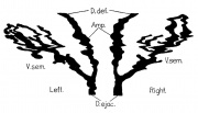 Ductus Deferens Development - Embryology