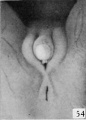 Fig. 54. No. 1476, 100 mm., female. X 4.