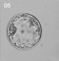 Human embryo day 5.jpg