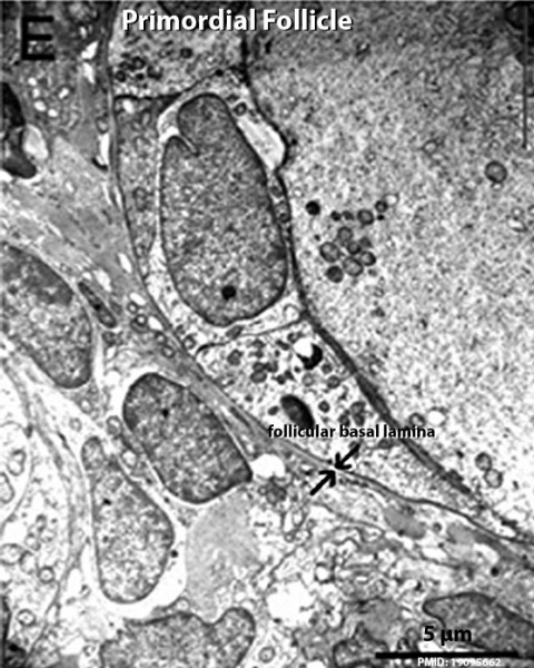 File:Human ovary follicle basement membrane EM01.jpg