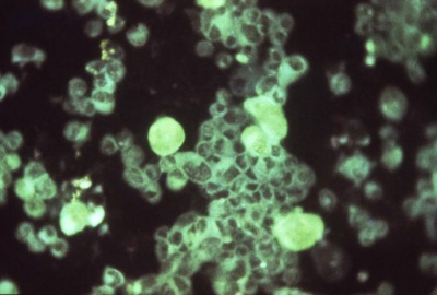 Cytomegalovirus Detection