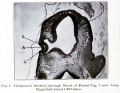 Fig. 4. Section through head of Foetal Pig, 3 mm long.