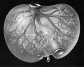 Fig 28 human embryo 24 mm