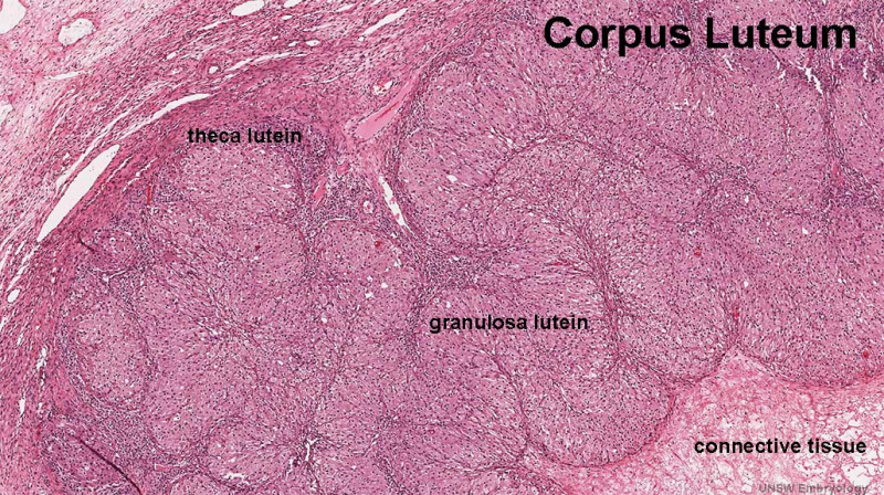 File:Ovary corpus luteum 01.jpg